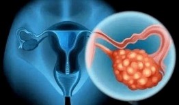 卵巢癌患者可以吃角瓜吗,角瓜的适宜摄入与注意事项