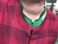 甲状腺可以吃生瓜